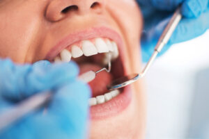dental malpractice 